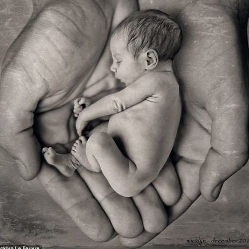 Holding an Abortion Survivor